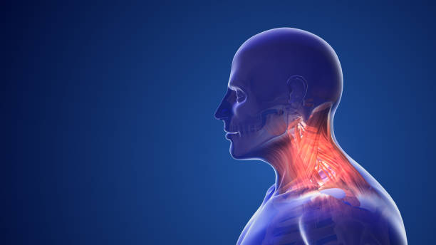Neck Pain