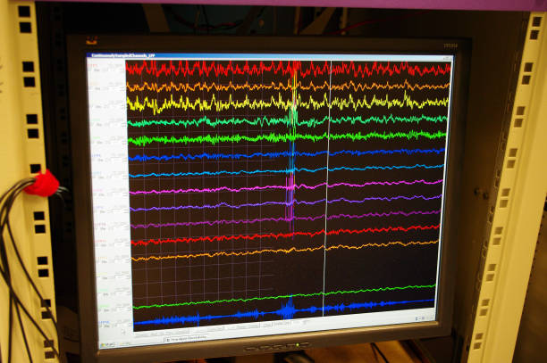 Video EEG